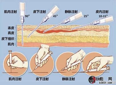 类固醇